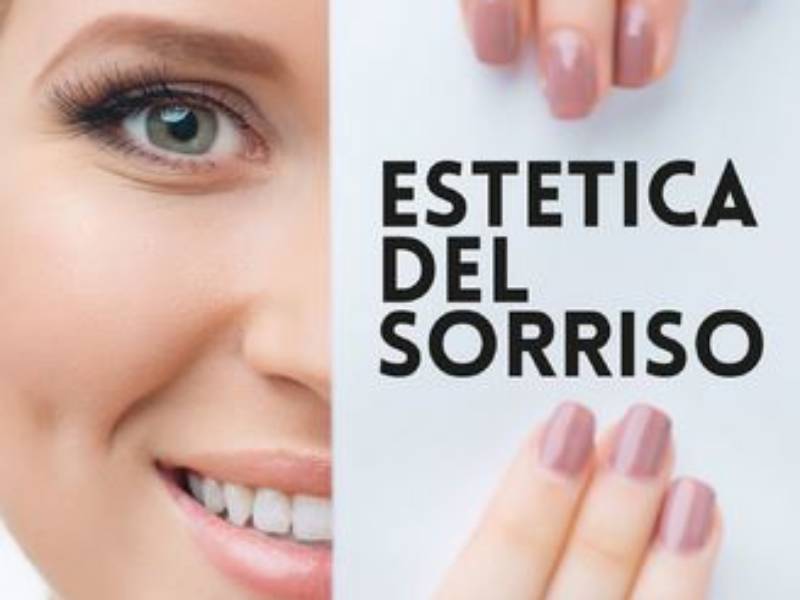 Estetica del sorriso