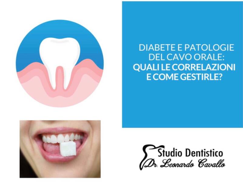 Diabete e cavo orale